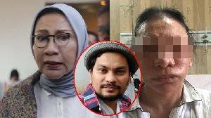 Ratna Sebut Tompi Sebagai Penyelamatnya